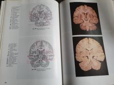 János Vajda: Atlas anatomiae I-II.-Anatómiai atlasz