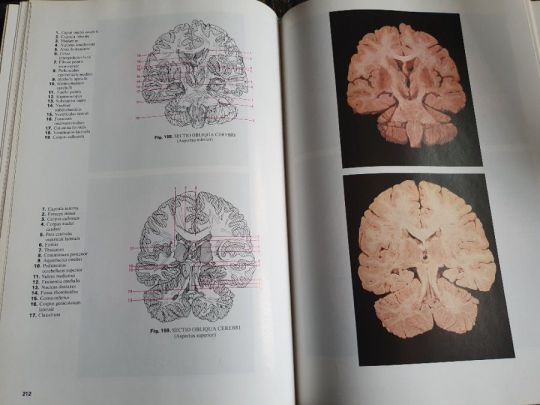 János Vajda: Atlas anatomiae I-II.-Anatómiai atlasz